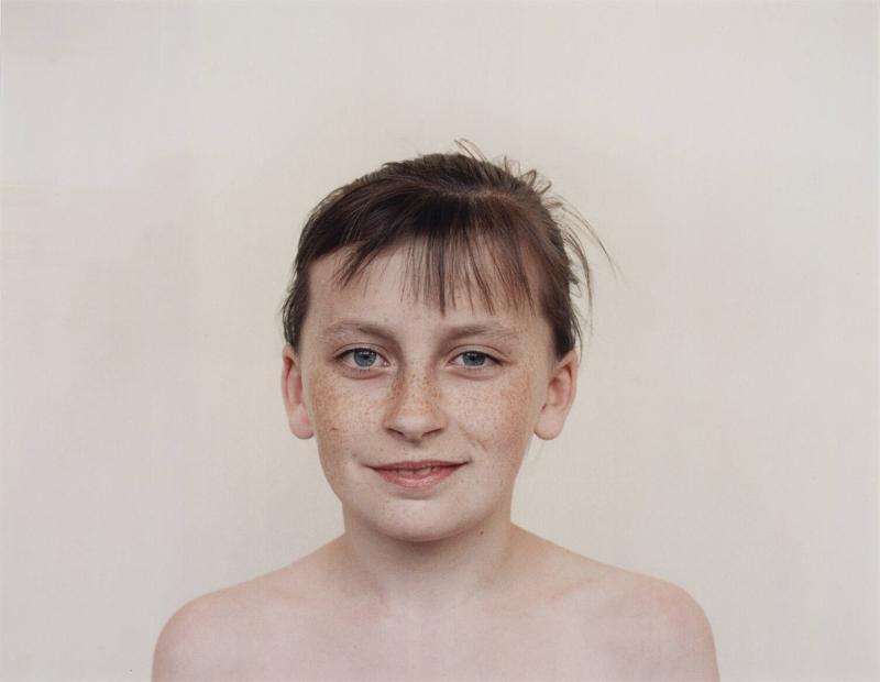 Children who have had a Thyroid Operation. From the series Echo of Silence