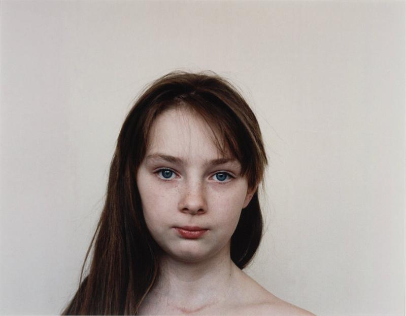 Children who have had a Thyroid Operation. From the Series Echo of Silence