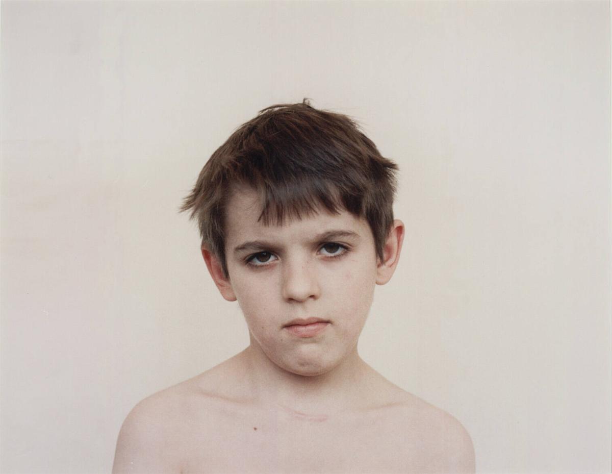 Children who have had a Thyroid Operation. From the Series Echo of Silence