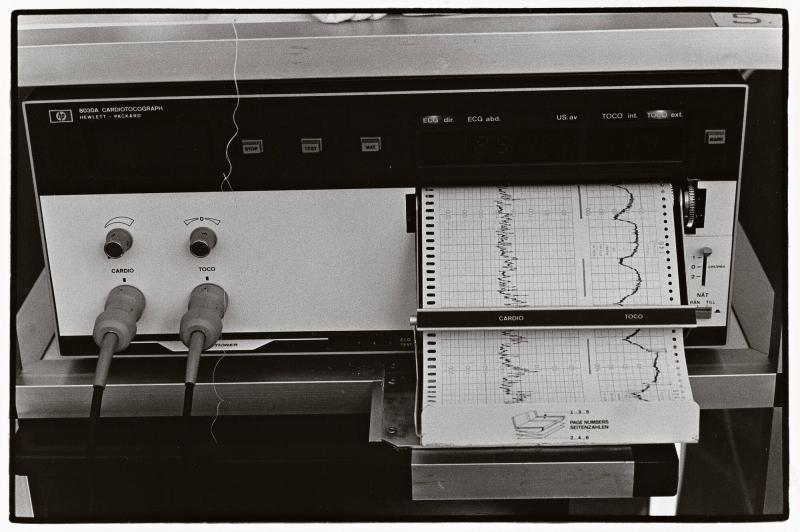 CTG-apparaten registrerar via två elektroder barnets hjärtslag och intensiteten i livmoderns sammandragniongar. När livmodersmunnen öppnat sig något flyttas den ena elektroden och fästs i huden på barnets huvud för bättre registrering. Ur serien Födelse
