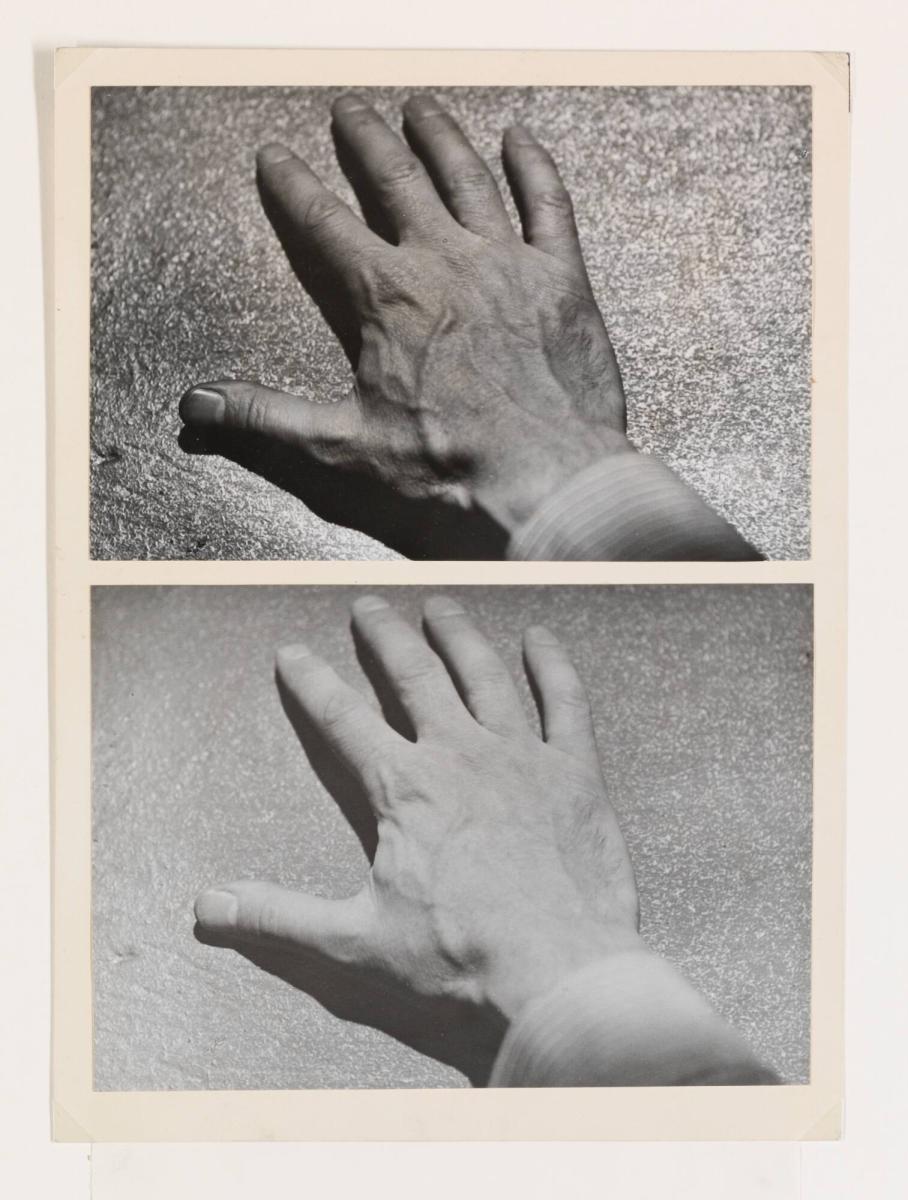 Bilder av en hand