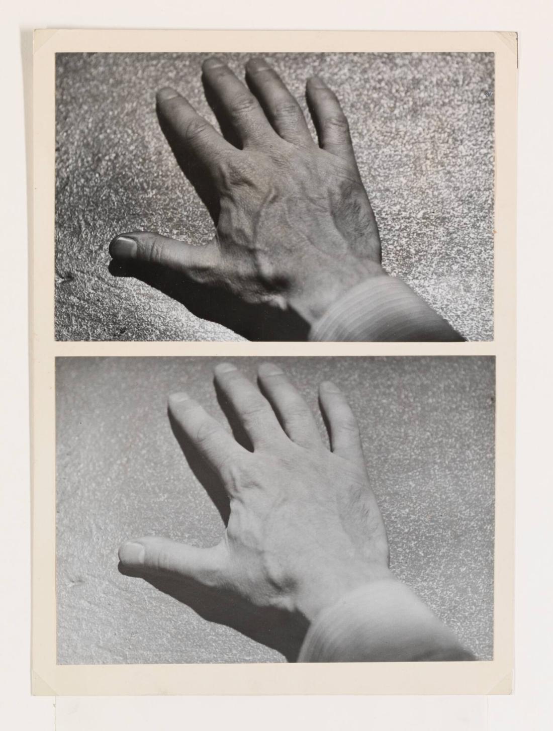 Bilder av en hand