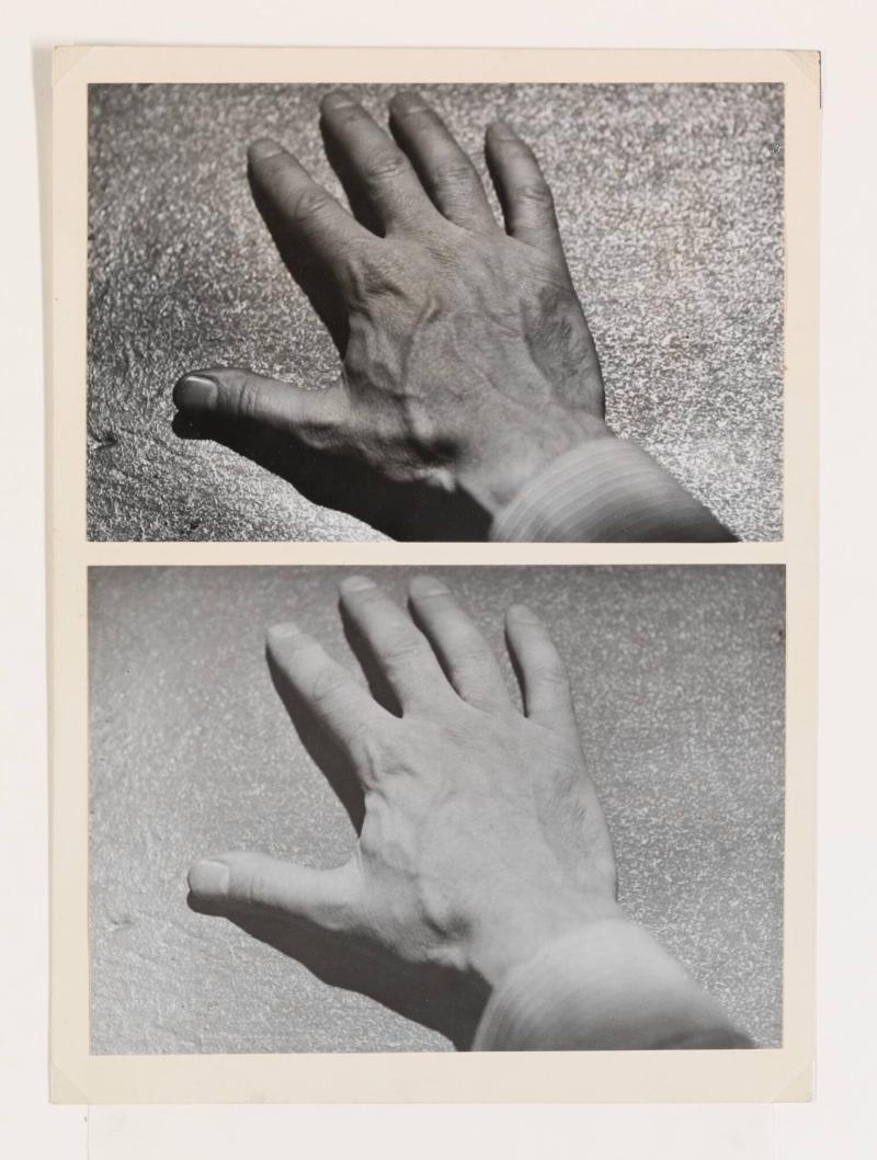 Bilder av en hand